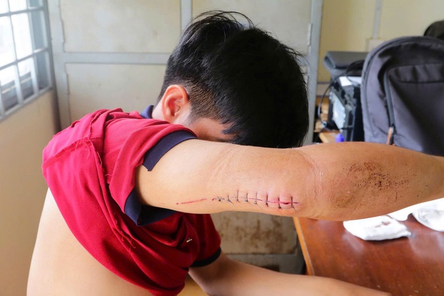 Nh&oacute;m thanh thiếu ni&ecirc;n mang dao tự chế đi ch&eacute;m người rồi chụp ảnh &ldquo;kỷ niệm&rdquo; - Ảnh 2.