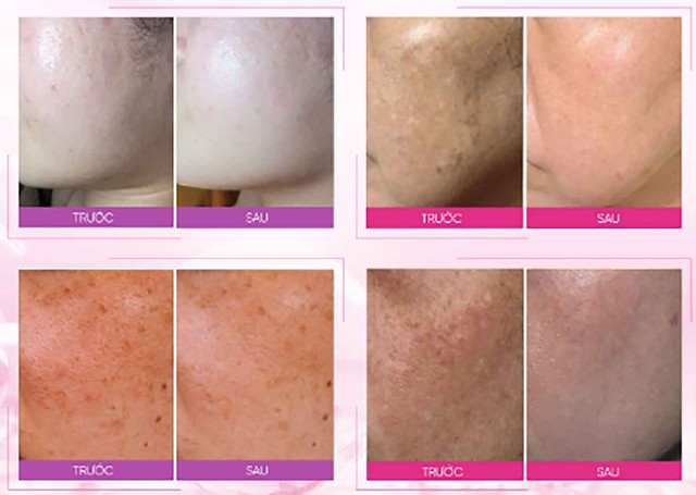 B&ocirc;i m&atilde;i kem mờ n&aacute;m đắt tiền da vẫn sạm đen, thử ngay top 4 dưới đ&acirc;y!- Ảnh 4.