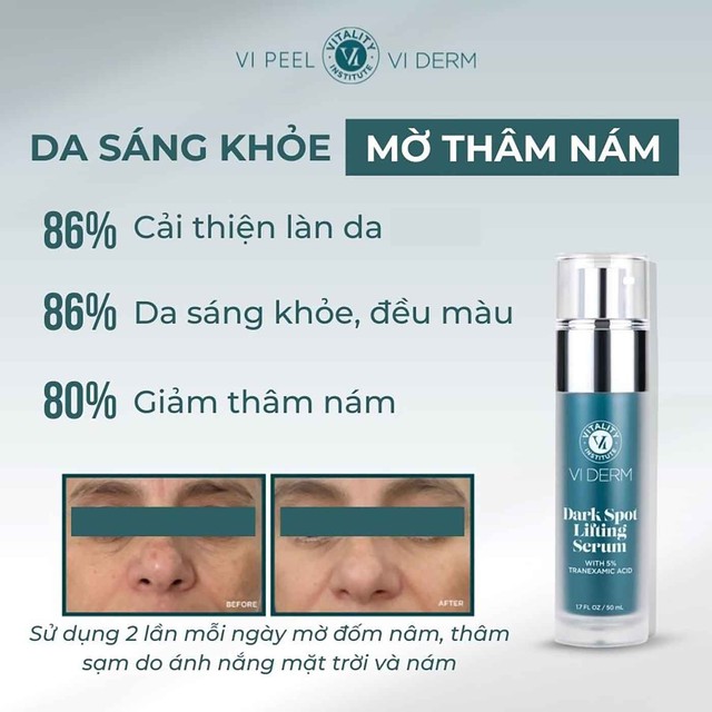 B&ocirc;i m&atilde;i kem mờ n&aacute;m đắt tiền da vẫn sạm đen, thử ngay top 4 dưới đ&acirc;y!- Ảnh 5.