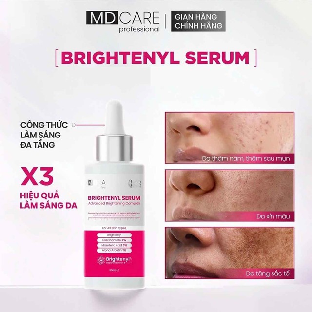 B&ocirc;i m&atilde;i kem mờ n&aacute;m đắt tiền da vẫn sạm đen, thử ngay top 4 dưới đ&acirc;y!- Ảnh 7.