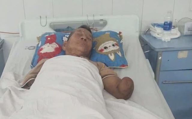 Cụ ông cụt 2 tay kẹp rắn hổ mang đem về nhà:Nhiều người tìm đến giúp đỡ - Ảnh 1.