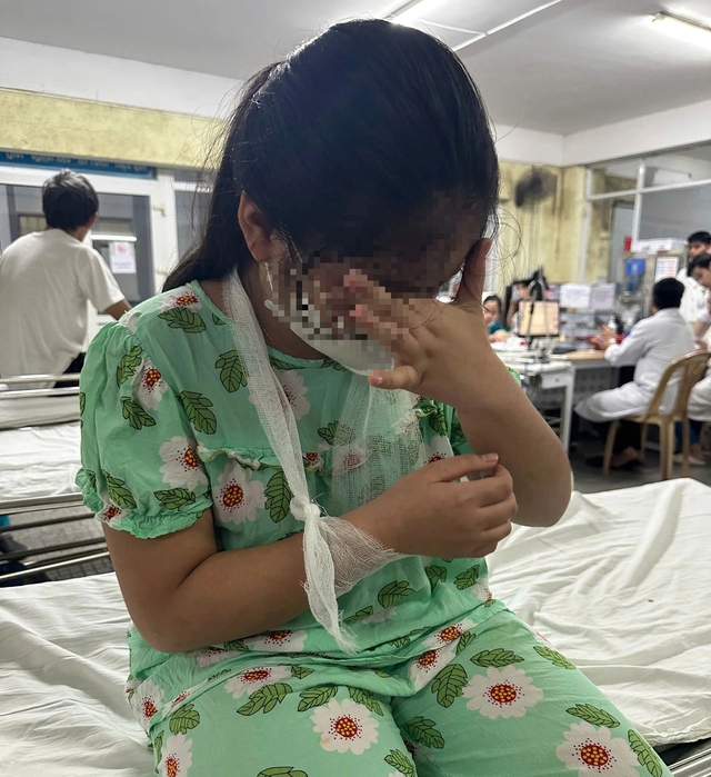 X&ocirc;n xao việc gi&aacute;o vi&ecirc;n d&ugrave;ng thước đ&aacute;nh học sinh tiểu học g&atilde;y tay - Ảnh 3.