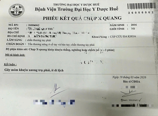 Đ&atilde; x&aacute;c minh vụ c&ocirc; gi&aacute;o d&ugrave;ng thước đ&aacute;nh học sinh tiểu học 'chấn thương' ở tay - Ảnh 2.