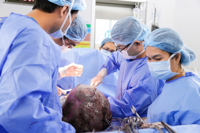 U xơ tử cung 12 kg, to như bụng song thai trong người c&ocirc; g&aacute;i 25 tuổi - Ảnh 1.