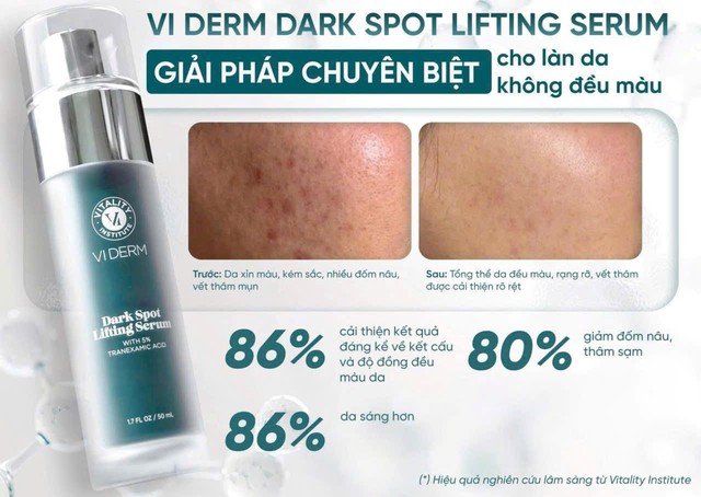 Top 5 kem giảm nám, đốm nâu hiệu quả sau 4 tuần, mờ cả nám lâu năm - Ảnh 4.