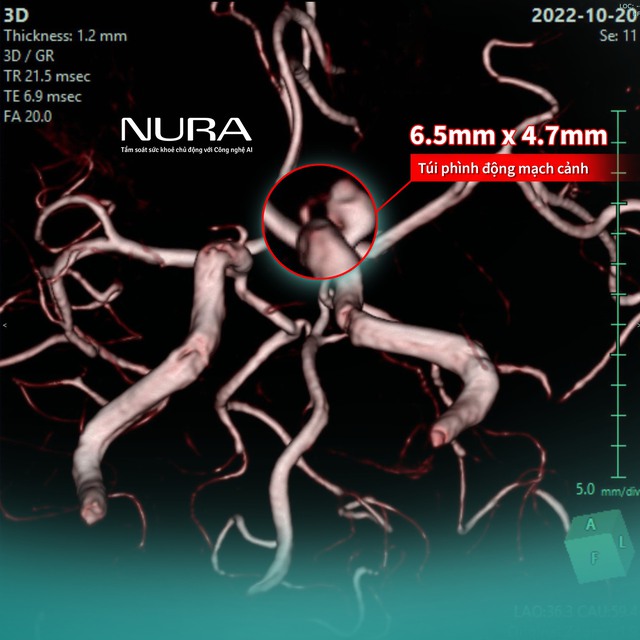 NURA Premium mở ra h&agrave;nh tr&igrave;nh chăm s&oacute;c sức khỏe trọn vẹn chuẩn Nhật Bản  - Ảnh 3.