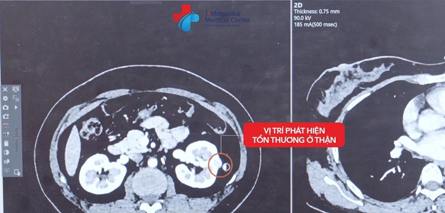 NURA Premium mở ra h&agrave;nh tr&igrave;nh chăm s&oacute;c sức khỏe trọn vẹn chuẩn Nhật Bản  - Ảnh 4.