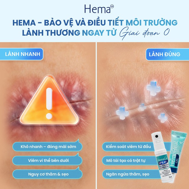 Từ chăm s&oacute;c truyền thống đến phục hồi chủ động với Hema - Ảnh 4.
