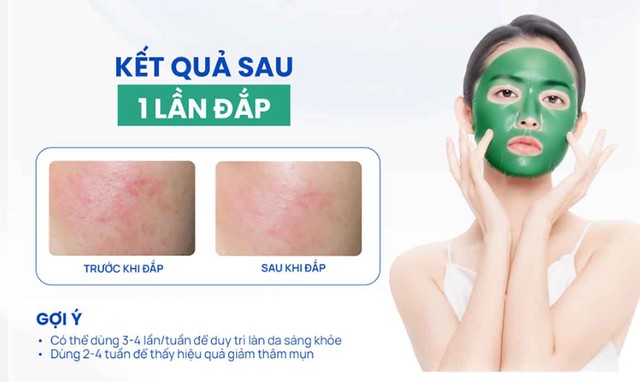 Hướng dẫn sử dụng mặt nạ Trioderma Blemish Care Essence Mask da cải thiện sau 1 đ&ecirc;m - Ảnh 4.
