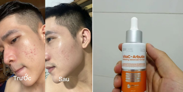 Top 6 serum gi&uacute;p trắng da sau 2 tuần khiến n&agrave;ng nhận ra trước giờ chọn sai- Ảnh 3.