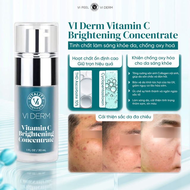 Top 6 serum gi&uacute;p trắng da sau 2 tuần khiến n&agrave;ng nhận ra trước giờ chọn sai- Ảnh 7.