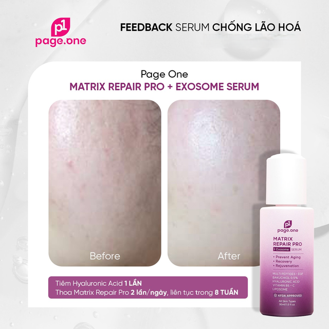 Top 6 serum gi&uacute;p trắng da sau 2 tuần khiến n&agrave;ng nhận ra trước giờ chọn sai- Ảnh 9.