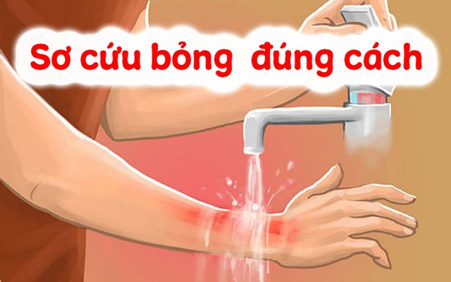 Qu&aacute; tr&igrave;nh l&agrave;nh vết bỏng: Sai một bước, sẹo cả đời - Ảnh 3.