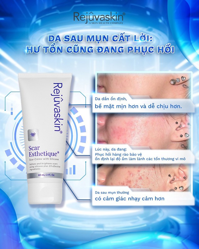 Hướng dẫn sử dụng kem mờ sẹo th&acirc;m Scar Esthetique đ&uacute;ng chuẩn để kh&ocirc;ng ph&iacute; tiền - Ảnh 3.