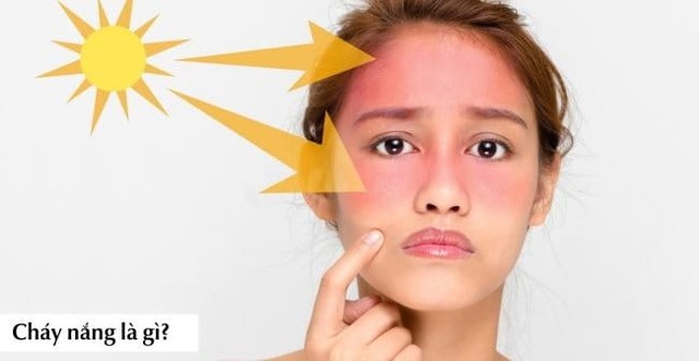 Nắng nóng gần 40 độ: Da bỏng rát, sạm màu? Cách phục hồi sau 1 đêm- Ảnh 2. Nắng nóng gần 40 độ: Da bỏng rát, sạm màu? Cách phục hồi sau 1 đêm- Ảnh 2.