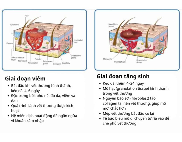 Timeline hồi phục sau cắt chỉ: Chăm sóc vết thương không để lại sẹo- Ảnh 2. Timeline hồi phục sau cắt chỉ: Chăm sóc vết thương không để lại sẹo- Ảnh 2.
