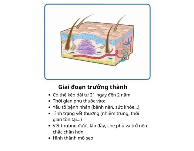 Timeline hồi phục sau cắt chỉ: Chăm sóc vết thương không để lại sẹo- Ảnh 3. Timeline hồi phục sau cắt chỉ: Chăm sóc vết thương không để lại sẹo- Ảnh 3.
