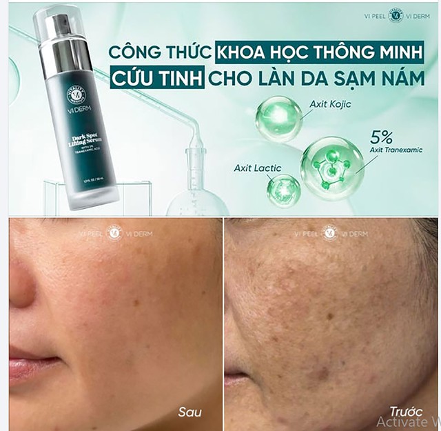 Top 5 kem mờ nám 'đắt tiền đến mấy' cũng mua vì hiệu quả nám chân sâu
- Ảnh 7. Top 5 kem mờ nám 'đắt tiền đến mấy' cũng mua vì hiệu quả nám chân sâu
- Ảnh 7.