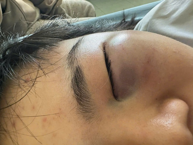 Nữ sinh lớp 7 bị nh&oacute;m nam sinh đ&aacute;nh hội đồng trước cổng trường: C&ocirc;ng an v&agrave;o cuộc- Ảnh 2.