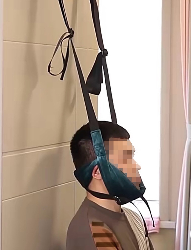 Cảnh b&aacute;o nguy cơ liệt do tự k&eacute;o gi&atilde;n cột sống cổ  - Ảnh 1.