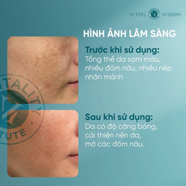 Top 6 kem chống l&atilde;o h&oacute;a cho tuổi 35+ &lsquo;l&atilde;o h&oacute;a ngược&rsquo; như g&aacute;i đ&ocirc;i mươi - Ảnh 3.