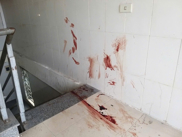 Người t&igrave;nh nghi li&ecirc;n quan vụ nữ sinh tử vong ở ph&ograve;ng trọ cũng thương t&iacute;ch nặng- Ảnh 1.