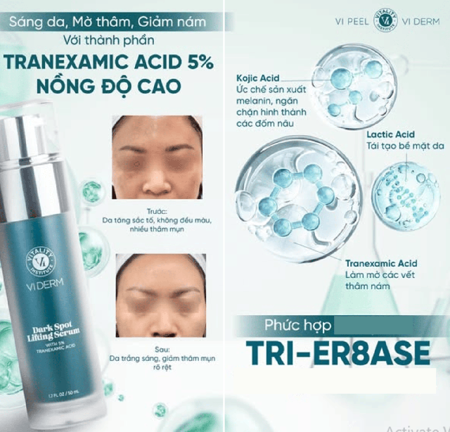 Top 5 serum gi&uacute;p &lsquo;tạm biệt&rsquo; n&aacute;m, thậm ch&iacute; n&aacute;m hỗn hợp tưởng như chưa tồn tại - Ảnh 3.