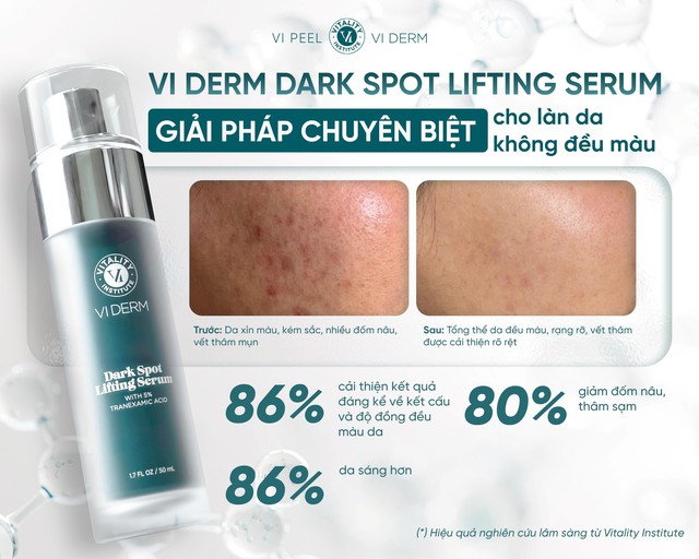 Top 5 serum gi&uacute;p &lsquo;tạm biệt&rsquo; n&aacute;m, thậm ch&iacute; n&aacute;m hỗn hợp tưởng như chưa tồn tại - Ảnh 4.
