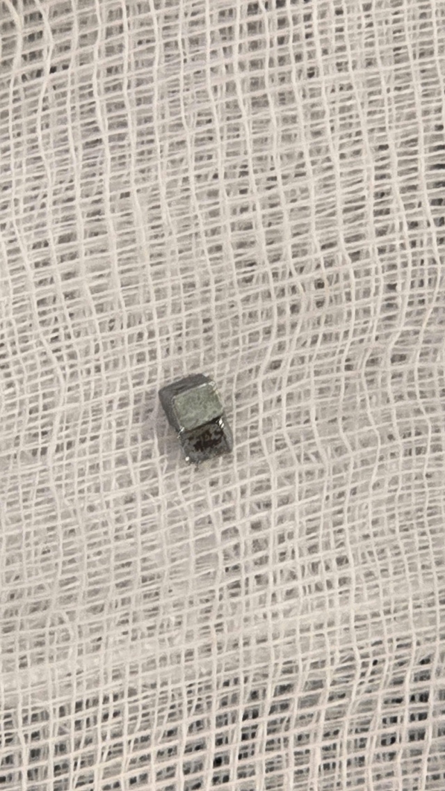 Bé trai 5 tuổi ho, đau họng, đi khám phát hiện nuốt 7 viên nam châm - Ảnh 1.