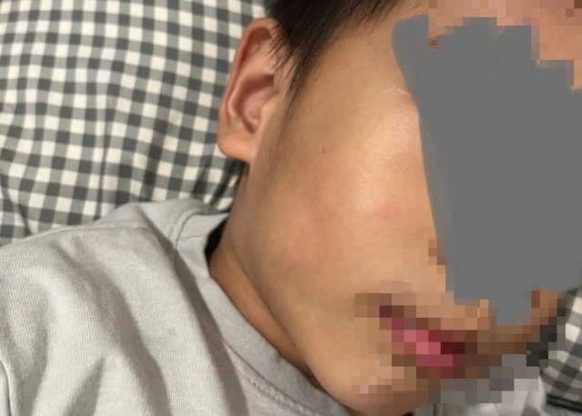 TP.HCM: Trường mầm non Hoa Lư đ&igrave;nh chỉ 2 c&ocirc; h&agrave;nh vi kh&ocirc;ng chuẩn mực với trẻ - Ảnh 1.