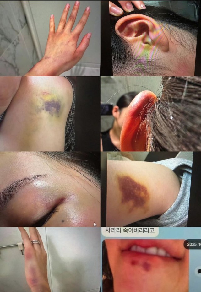 Chị d&acirc;u Jisoo (BlackPink) kh&ocirc;ng biết em chồng l&agrave; người nổi tiếng giữa tin đồn bạo h&agrave;nh - Ảnh 3.