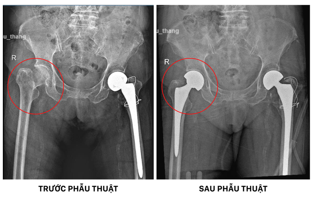 Hai lần đặt cược v&agrave;o nền y học Việt Nam của cụ b&agrave; ngoại quốc gần trăm tuổi- Ảnh 3.
