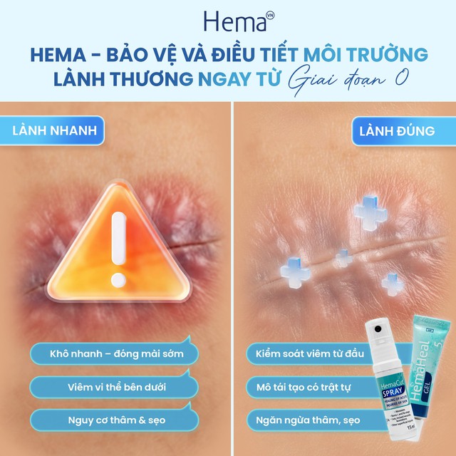 Chuy&ecirc;n gia giải đ&aacute;p: Vết thương hở n&ecirc;n b&ocirc;i g&igrave; để tr&aacute;nh sẹo xấu? - Ảnh 8.