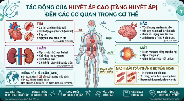 Huyết &aacute;p cao ảnh hưởng đến cơ thể thế n&agrave;o? - Ảnh 2.