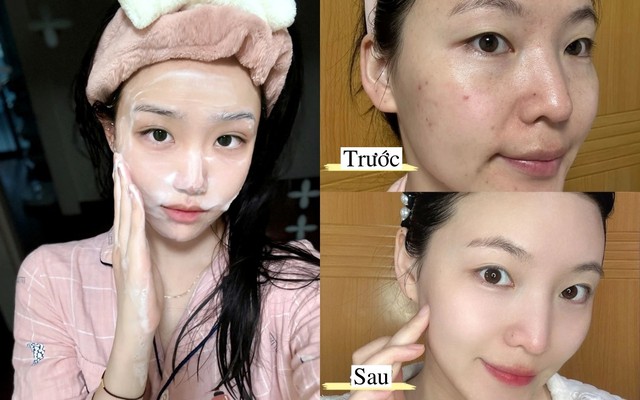 Top 7 sữa rửa mặt cho da dầu mụn sạch s&acirc;u, giảm b&oacute;ng nhờn d&ugrave; đang h&egrave; - Ảnh 1.