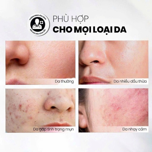 Top 7 sữa rửa mặt cho da dầu mụn sạch s&acirc;u, giảm b&oacute;ng nhờn d&ugrave; đang h&egrave; - Ảnh 5.