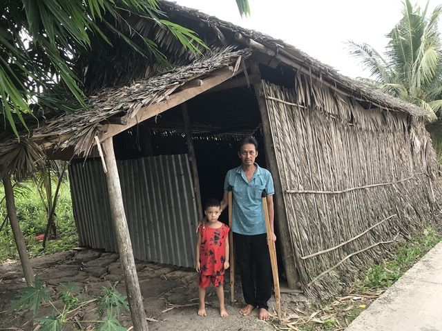 Bị hoại tử chỏm xương đùi, người đàn ông nghèo mong được giúp đỡ- Ảnh 1.