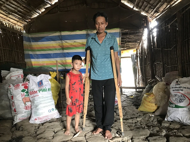 Bị hoại tử chỏm xương đùi, người đàn ông nghèo mong được giúp đỡ- Ảnh 2.