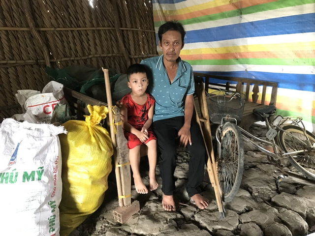 Bị hoại tử chỏm xương đùi, người đàn ông nghèo mong được giúp đỡ- Ảnh 3.