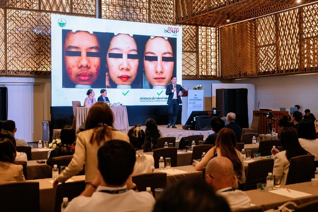 Dược mỹ phẩm trị mụn: Chiến lược cấp tốc hay giải ph&aacute;p l&acirc;u d&agrave;i cho l&agrave;n da? - Ảnh 3.