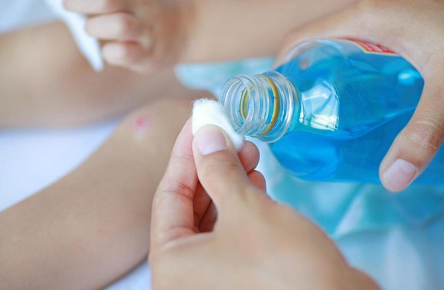 Bật m&iacute; c&aacute;ch xử l&yacute; vết thương chuẩn y khoa m&agrave; nhiều người thực hiện sai- Ảnh 4.