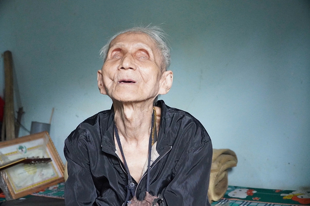 Cụ &ocirc;ng m&ugrave; l&ograve;a sống vất vả một m&igrave;nh - Ảnh 1.