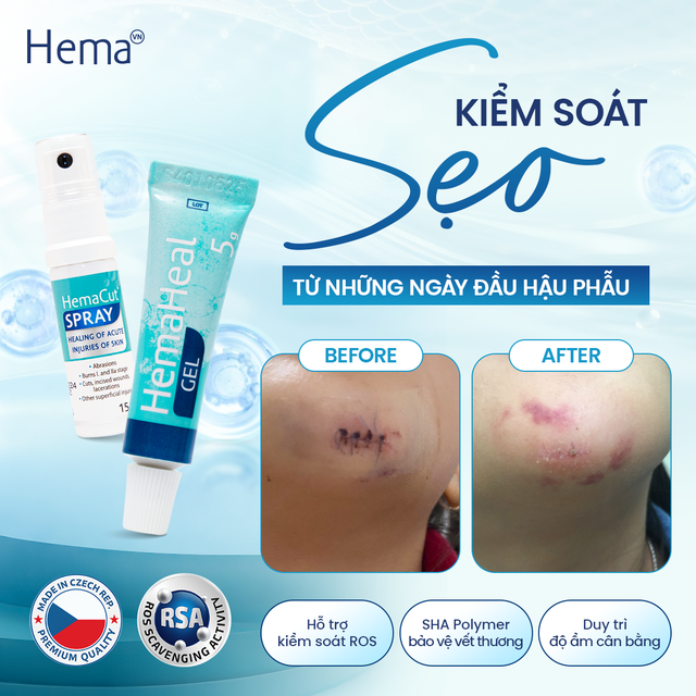 V&igrave; sao giai đoạn đầu mang t&iacute;nh quyết định đến kết quả hồi phục?- Ảnh 4.