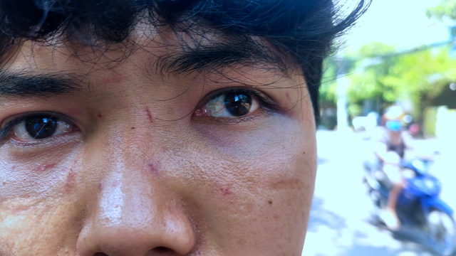 H&agrave;nh hung người b&aacute;n b&aacute;nh b&egrave;o ở Quy Nhơn 2026: C&acirc;u chuyện đau l&ograve;ng từ phường Quy Nhơn Nam - Ảnh 3.