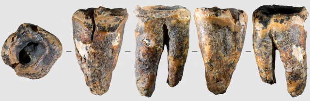 59.000 năm trước, người Neanderthal đã biết trị sâu răng?- Ảnh 1. 59.000 năm trước, người Neanderthal đã biết trị sâu răng?- Ảnh 1.