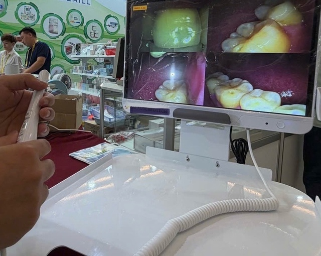 Mỗi người dân sẽ được khám bệnh răng miệng ít nhất 1 lần/năm- Ảnh 1.