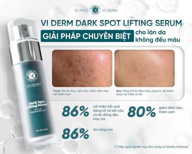 5 serum mờ n&aacute;m l&acirc;u năm kh&ocirc;ng cần laser: L&agrave;m mờ đốm n&acirc;u, l&agrave;n da trắng s&aacute;ng - Ảnh 5.