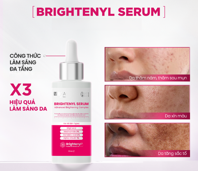 5 serum mờ n&aacute;m l&acirc;u năm kh&ocirc;ng cần laser: L&agrave;m mờ đốm n&acirc;u, l&agrave;n da trắng s&aacute;ng - Ảnh 9.