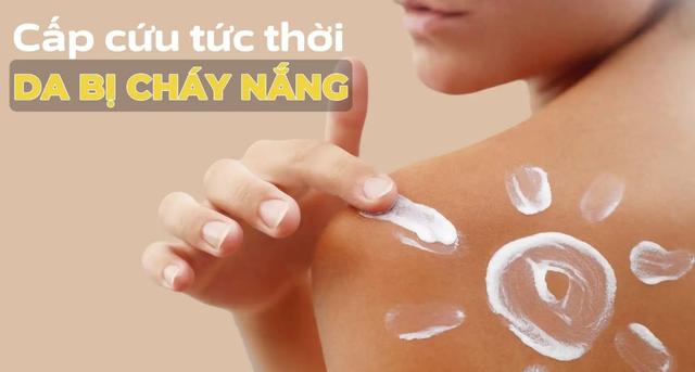 5 mẹo chống nắng ‘sống còn’ khi đi du lịch: Da trắng hồng bất chấp nắng gắt - Ảnh 4.
