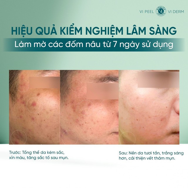 Thử ngay 5 serum trắng da này nếu da đang xỉn màu và lão hóa trước tuổi - Ảnh 7.